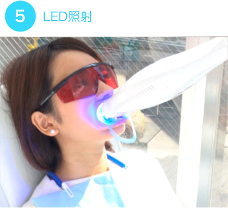 LED照射